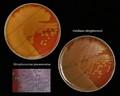 Streptococcus pneumoniae colonies compared with colonies of viridans streptococci